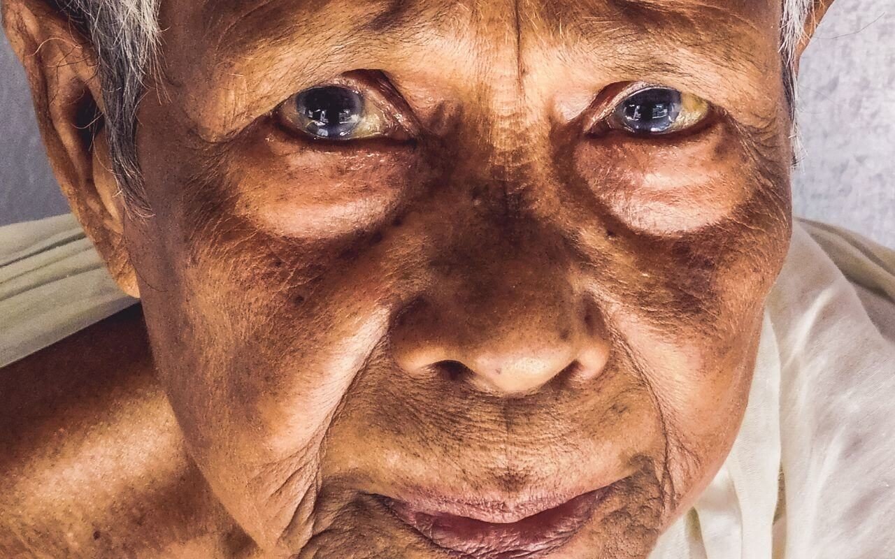 Revitimizacao-das-vitimas-de-danos-na-saude-e-a-ausencia-de-um-sistema-de-queixas-de-pacientes-no-Brasil-1