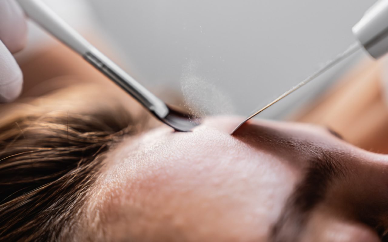 Ultrasonic cleaning of the face. Skin peeling.